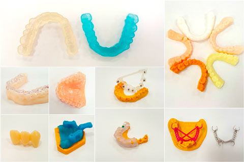 produits 3D prothèses dentaires