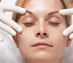 blepharoplastie en tunisie