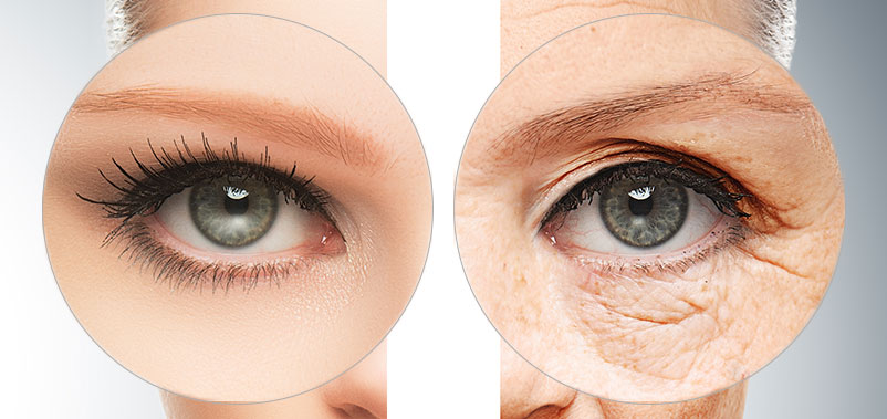 plexr-blepharoplastie-sans-chirurgie