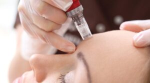 mesotherapie-faciale-belgique
